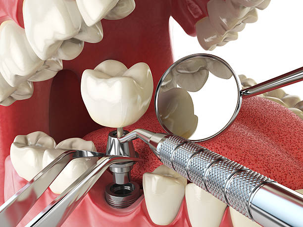 Best Walk-In Dentist Near Me  in Buchanan Dam, TX